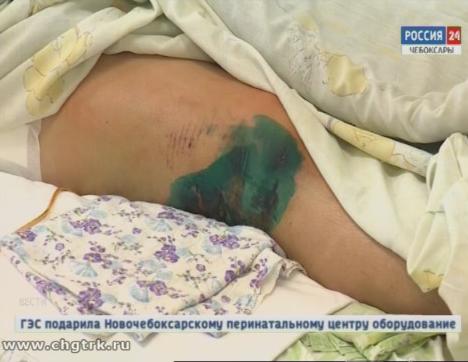 Уличный, школьный и бытовой травматизм: как не оказаться на больничной койке в новогодние каникулы? Уличный, школьный и бытовой травматизм: как не оказаться на больничной койке в новогодние каникулы?