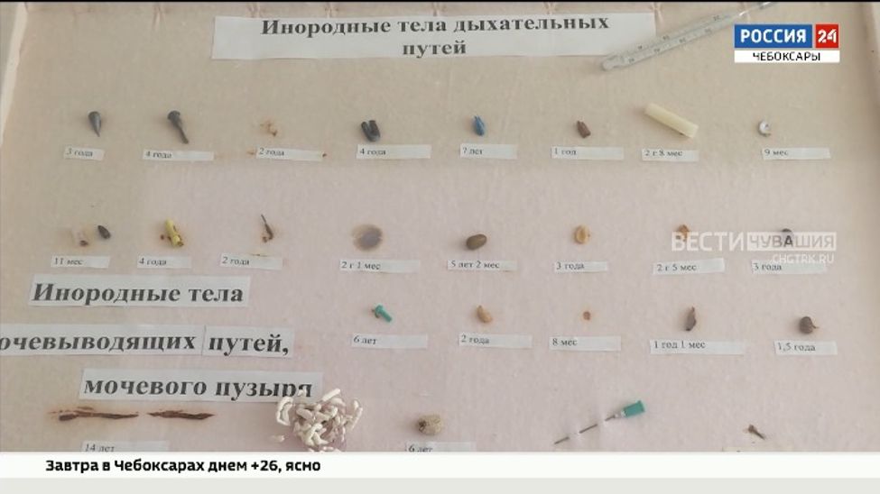 Хирурги Чувашии всё чаще сталкиваются со случаями, когда дети проглатывают мелкие предметы Хирурги Чувашии всё чаще сталкиваются со случаями, когда дети проглатывают мелкие предметы