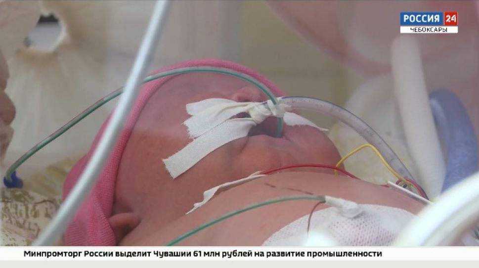 В Минздраве Чувашии рассказали о самом действенном методе профилактики младенческой смертности В Минздраве Чувашии рассказали о самом действенном методе профилактики младенческой смертности