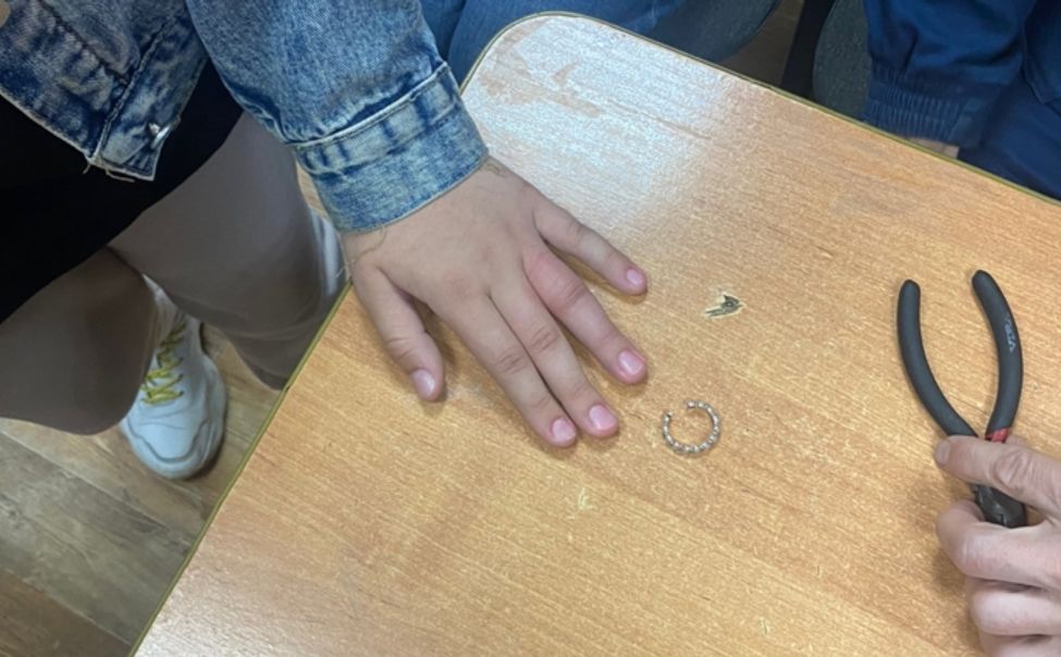 В Чувашии спасатели сняли застрявшее кольцо с опухшего пальца девочки