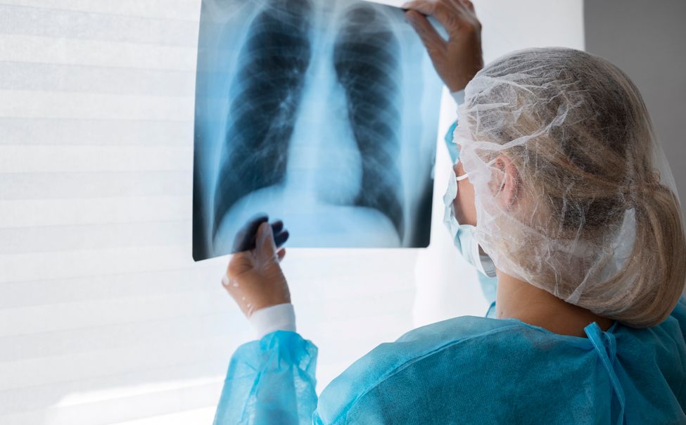 В Чувашии выявлено более 500 случаев рака легких