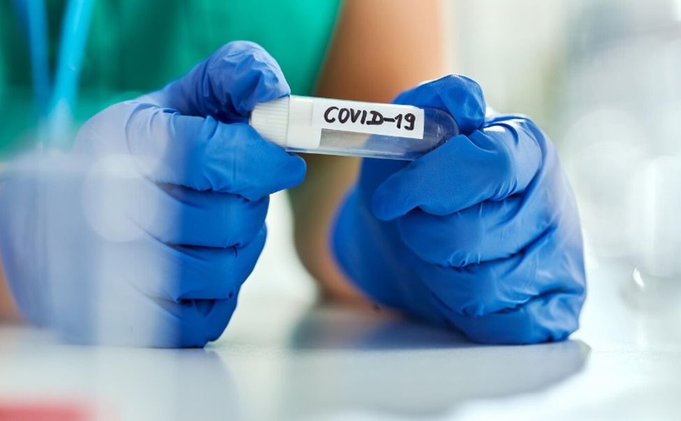 За неделю заболеваемость коронавирусом в Чувашии снизилась почти на 37%