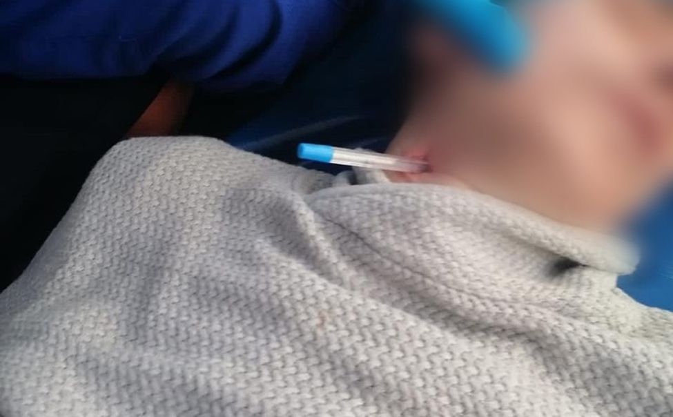 Чувашские хирурги спасли пациента с шариковой ручкой в шее