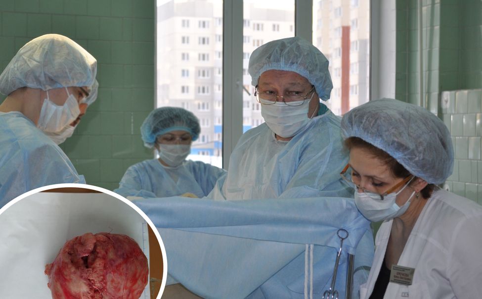 В Чебоксарах после принятия родов врачи удалили у женщины гигантскую опухоль