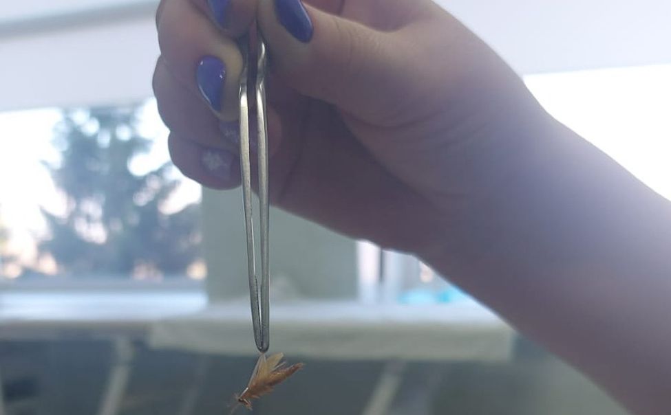 В Чувашии врачи извлекли жука из уха подростка